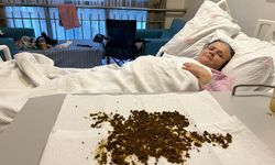 Ameliyat olan bir kadından 20 binin üzerinde taş çıkarıldı