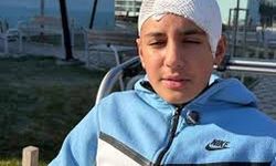 Şakalaştığı okul arkadaşı, taşla Hasan Berat’ı hastanelik etti