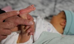 Bebeğe kayyum atanabilir