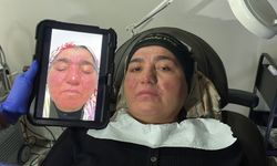 Hastalığı yüzünden yıllarca evden çıkamadı, şimdi ise çekinmeden çıkabiliyor