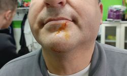 Maç sonrası gerginlik: 2 gazeteci darbedildi, 2 polis yaralandı