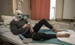 Çakmağına gaz doldurduğu tüpün patlamasıyla yüzü yandı