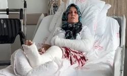Kavgada 3 çocuk annesinin kolu ve bacağı kırıldı