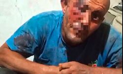 Sanal medyadaki videoları ile tanınan zihinsel engelli darbedildi