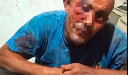 Sanal medyadaki videoları ile tanınan zihinsel engelli darbedildi
