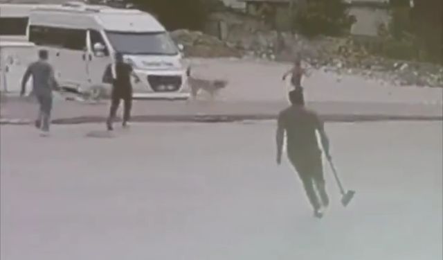 Sokak köpekleri çocuğa saldırdı