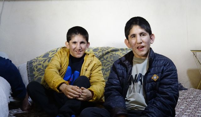 13 yaşındaki ikizler Kromozom 4q Delesyon Sendromu ile mücadele ediyor