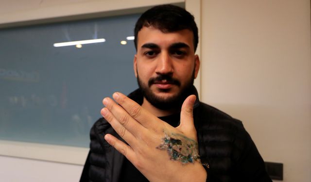 Dövme sildirmek isterken kabusu yaşadı, elindeki dokular öldü