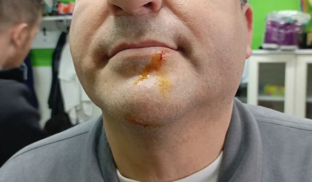 Maç sonrası gerginlik: 2 gazeteci darbedildi, 2 polis yaralandı