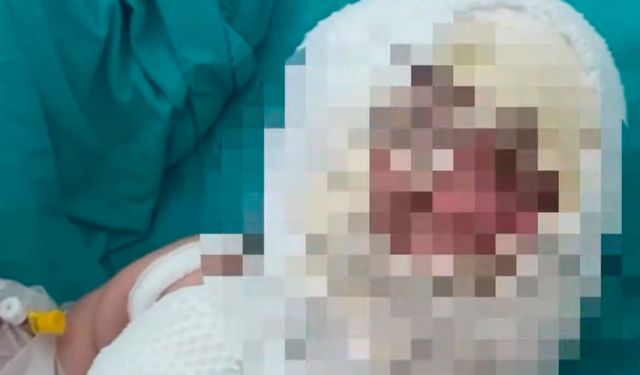9 aylık Eliz’in mucize kurtuluşu