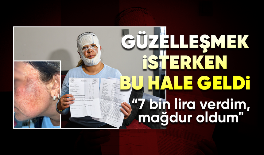 Güzelleşmek uğruna gittiği merkezde yüzü yandı