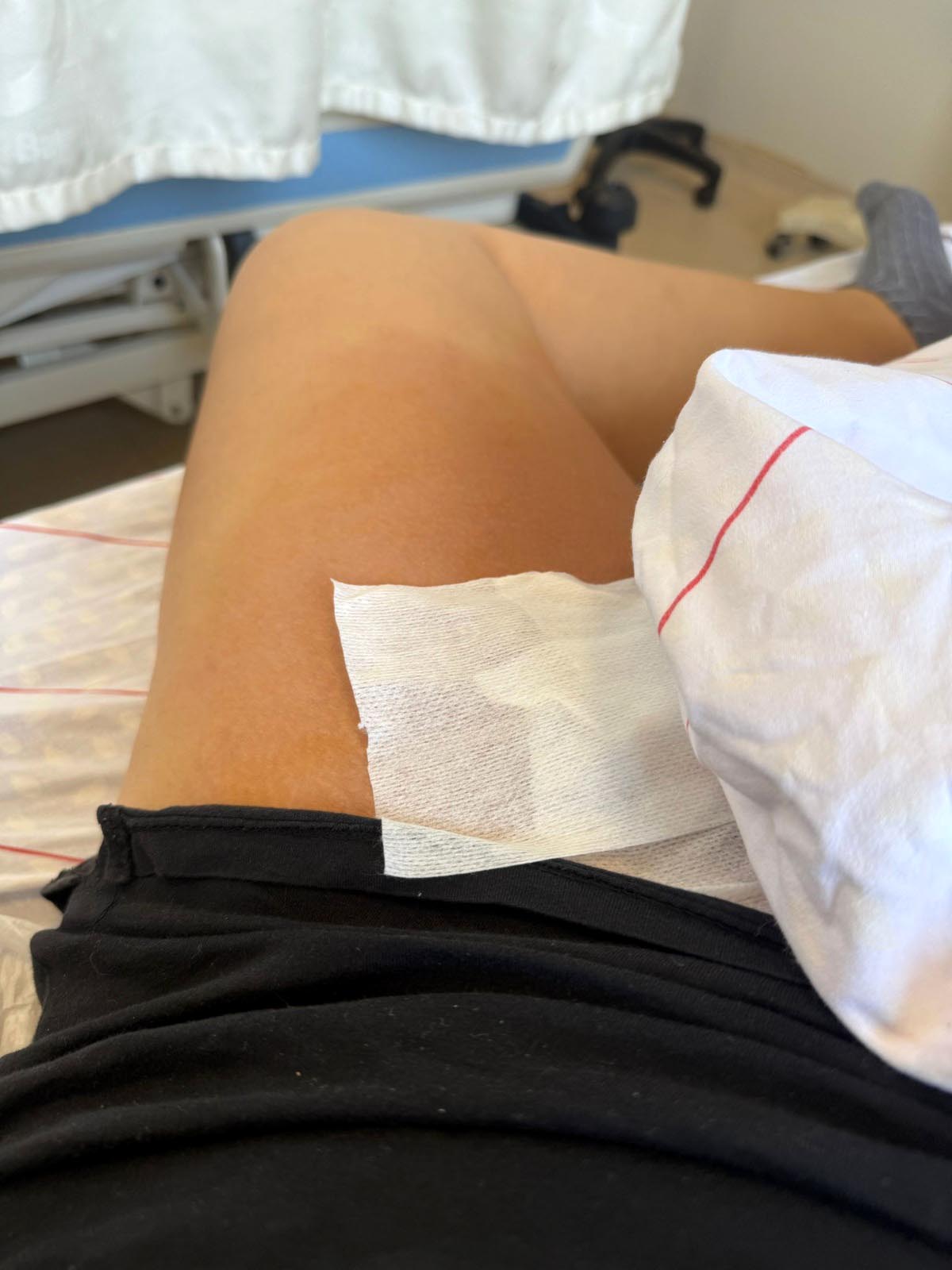 L A Z E R E P I L A S Y O N I S L E M I N D E G U Z E L L I K S A L O N 1162255 345139